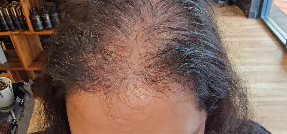 Mesh Hair Integration: Perth’s Leading Solution for Female Hair Loss”