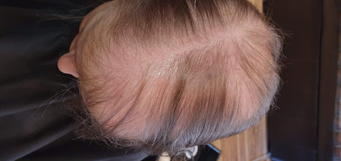 Chemo Wigs Perth | Same-Day Medical Grade & Human Hair Wigs