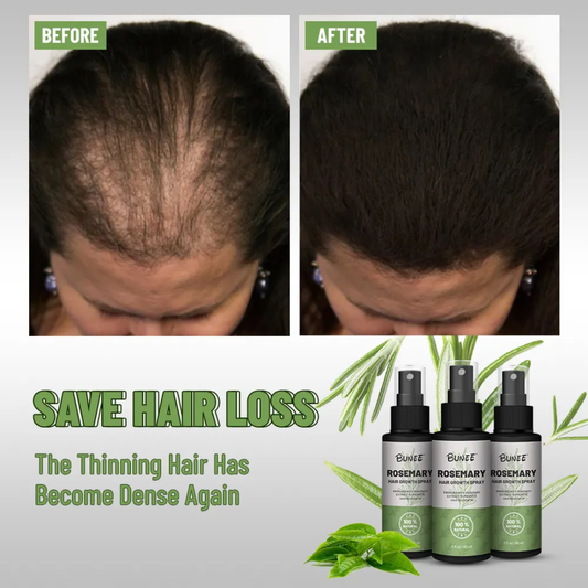 Does Rosemary Work for Hair Loss? The Science of Follicle Reactivation